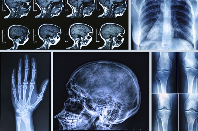 XrayScan